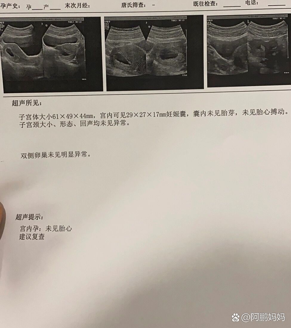 分享实测“有没有优乐字牌可以装挂吗”分享用挂教程-第2张图片